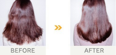地肌のかゆみやフケに悩まされ、自分に合うヘアケア用品を探し続けた10年間
