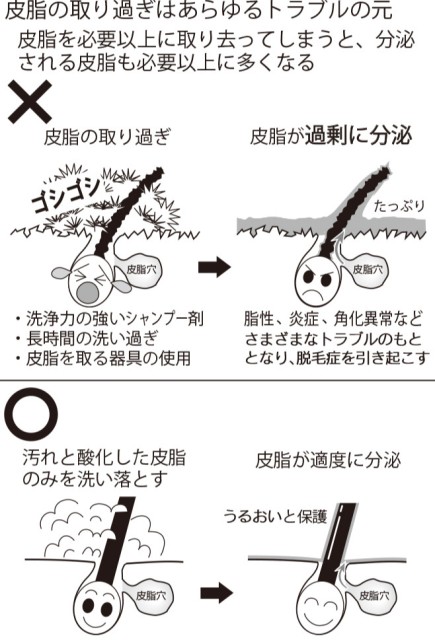 皮脂の取り過ぎはあらゆるトラブルの元