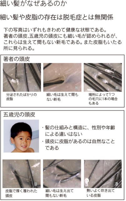 細い髪がなぜあるのか