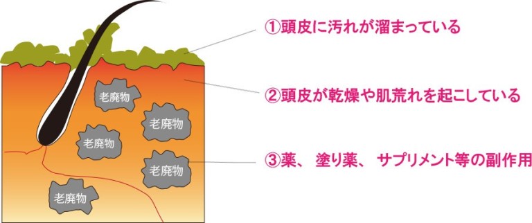 主な原因